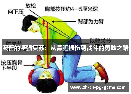 波普的坚强复苏:从肾脏损伤到战斗的勇敢之路